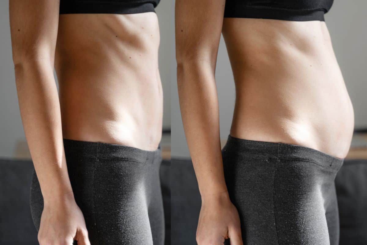 How long does diastasis recti take to improve Mitcham?