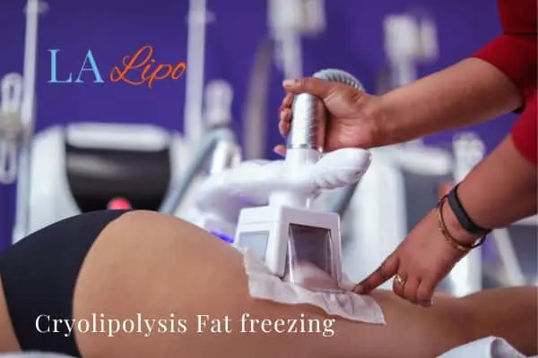 women getting fat freezing Mitcham