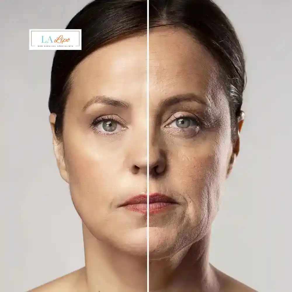 How Can You Tell If Non-Surgical Skin Tightening Is Right for You Mitcham?